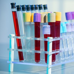 HGH Deficiency Blood Testing